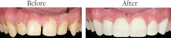 Bayside dental images